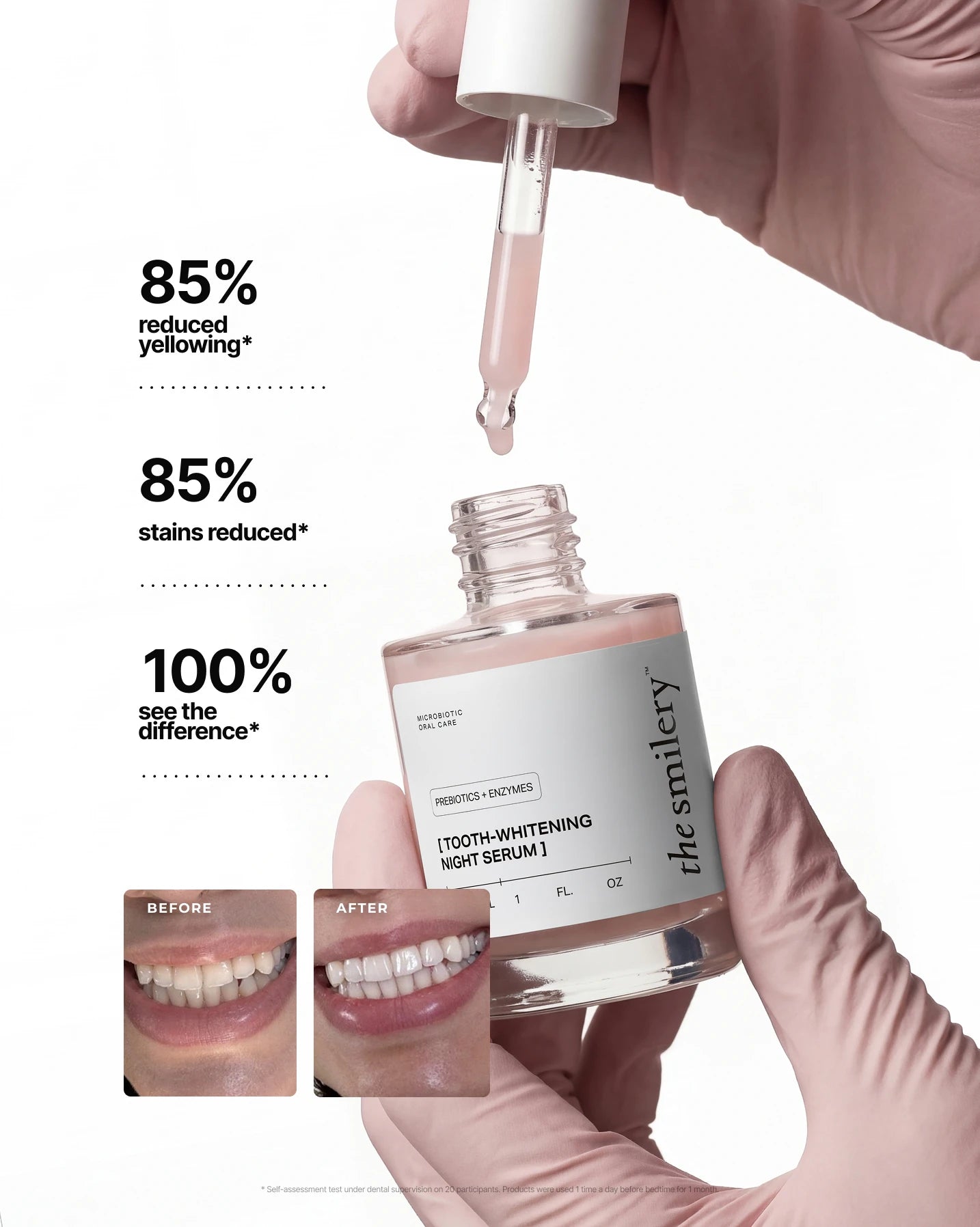 Overnight Whitening Kit